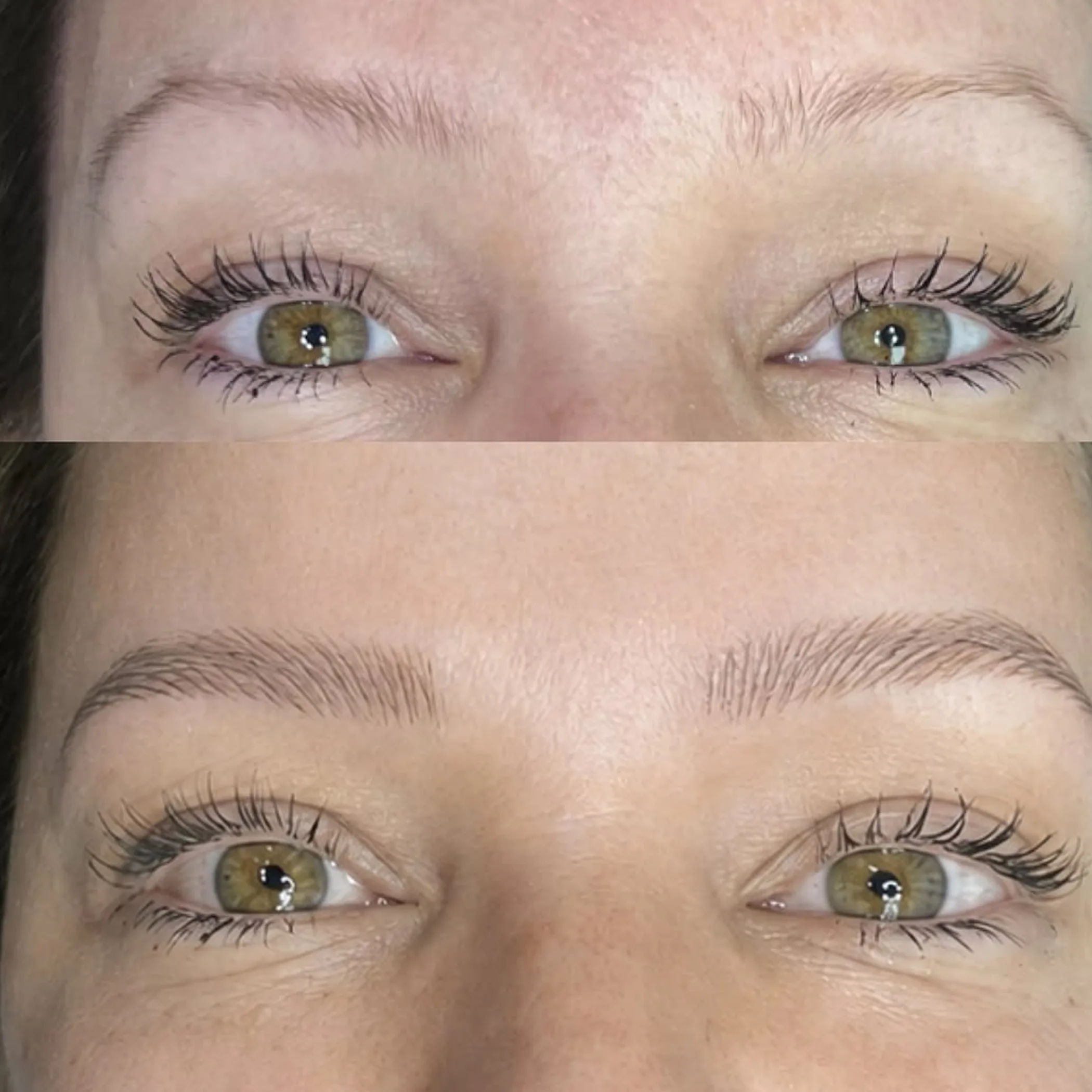 before and after combination brow healing results